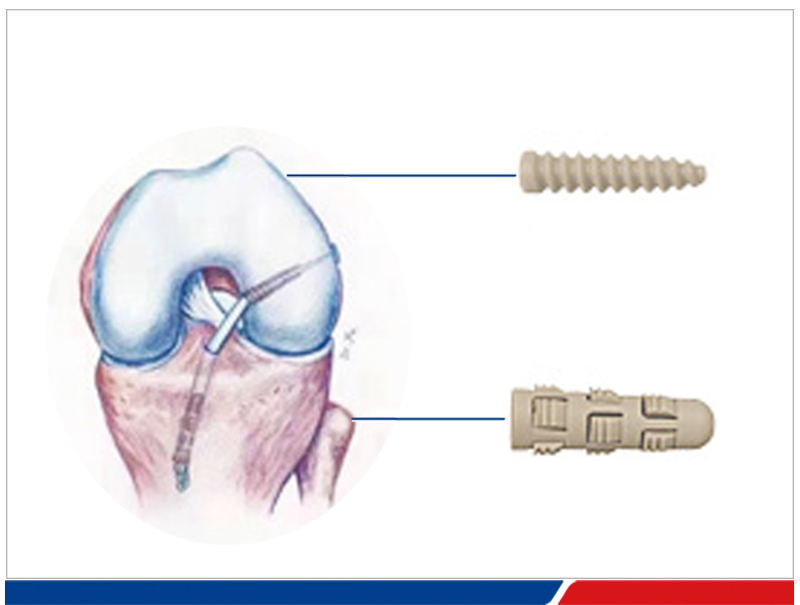 peek-star-wheel-11-600x232-1