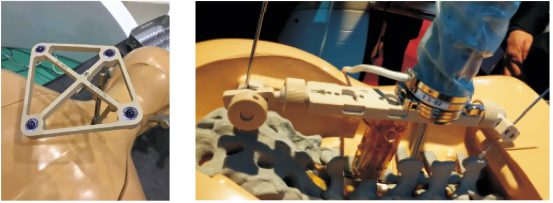 peek-star-wheel-11-600x232-1